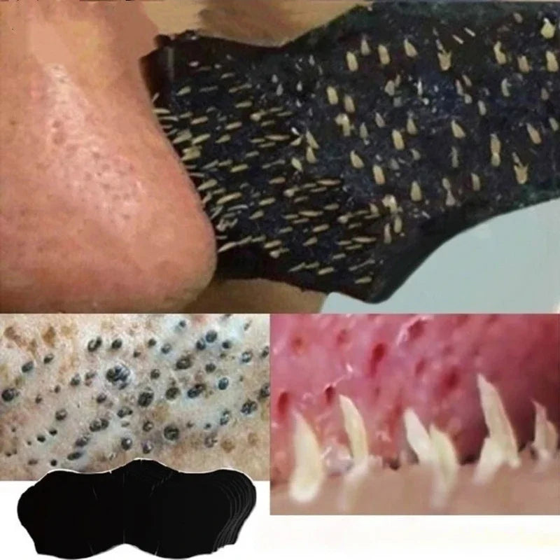 Blackhead Removal Nose Strips