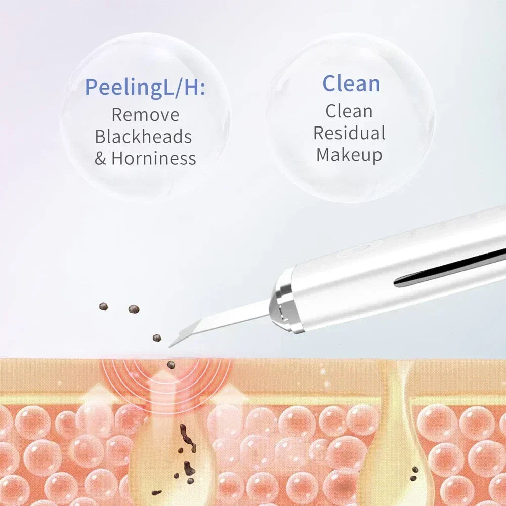 Electric Facial Pore Cleansing Spatula
