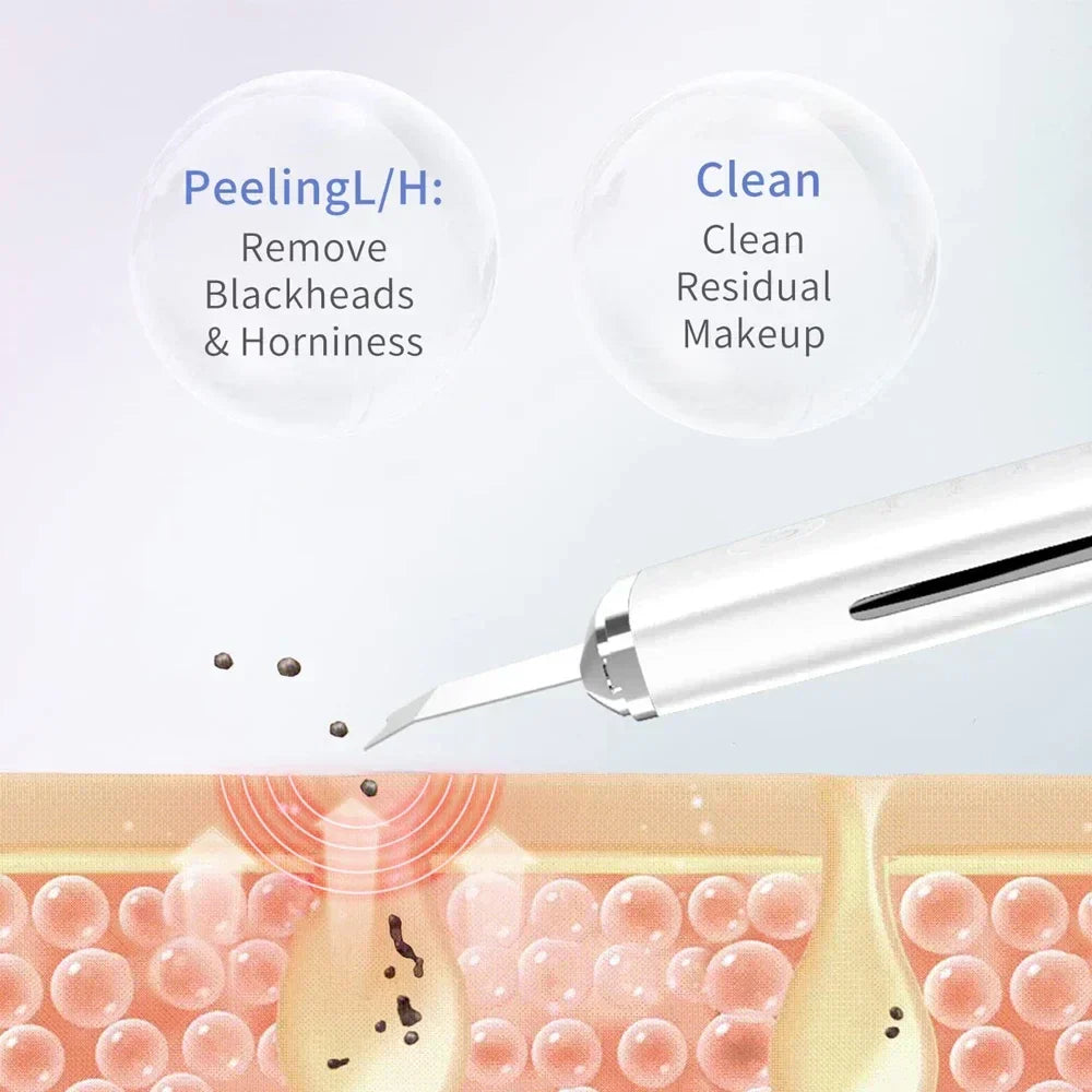Ultrasonic Facial Skin Scrubber Cleanser